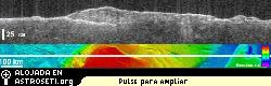 La imagen superior es un 