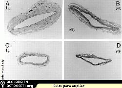 <i>Delp est� examinando la hip�tesis de que los vasos sangu�neos de las ratas se vuelven m�s finos y d�biles en microgravedad real, tal como sucede en microgravedad simulada, como se muestra en las im�genes B y D (las im�genes A y C muestran vasos sangu�neos de control en gravedad normal).</i>