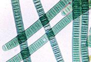Las cianobacterias (arriba) se convirtieron en los primeros microbios en producir oxgeno por fotosntesis.
Crdito: UC Berkeley 